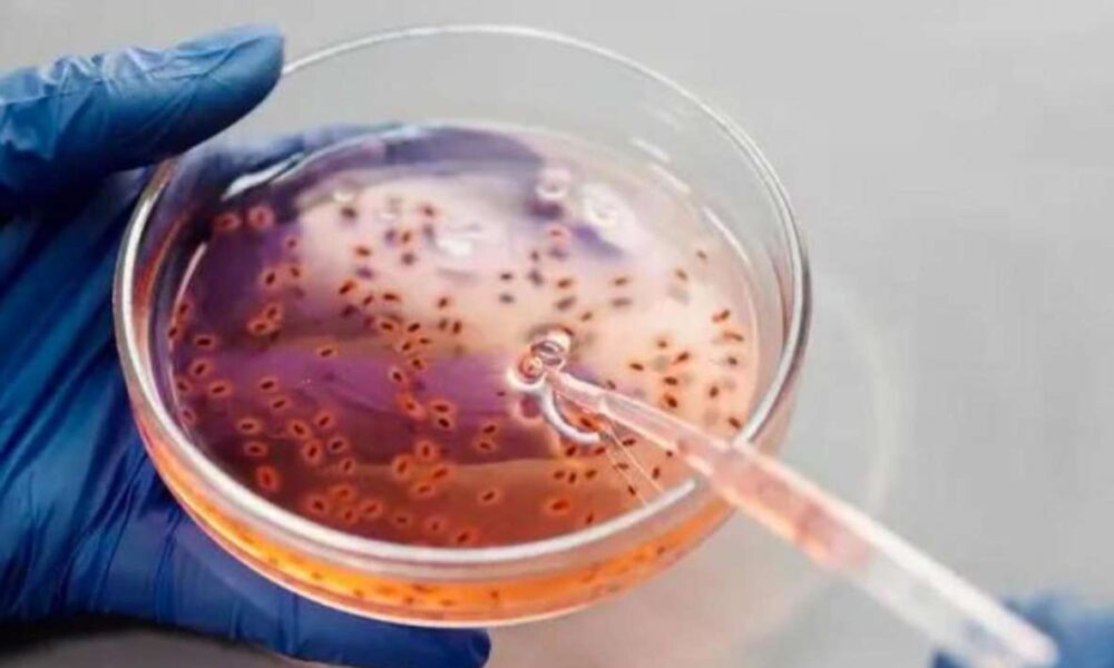 Secretaría de Salud reporta 13 muertes infantiles por posible contaminación de bacteria Klebsiella oxytoca