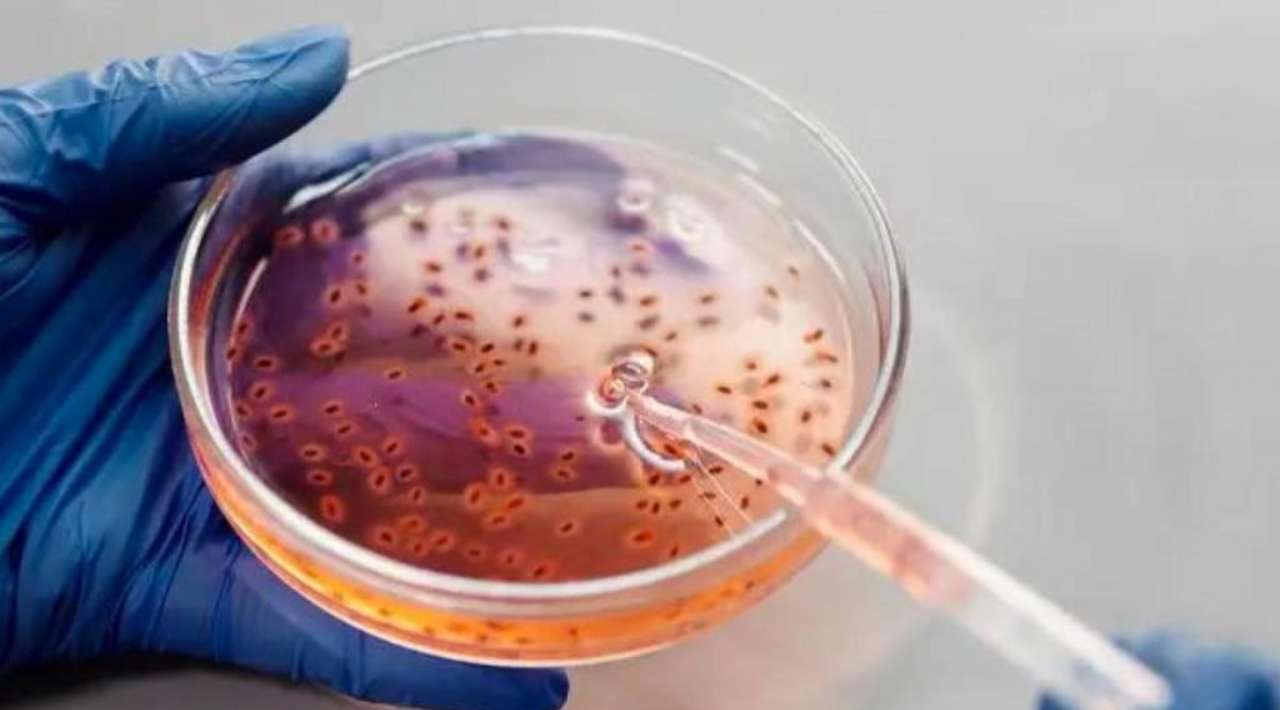 Secretaría de Salud reporta 13 muertes infantiles por posible contaminación de bacteria Klebsiella oxytoca