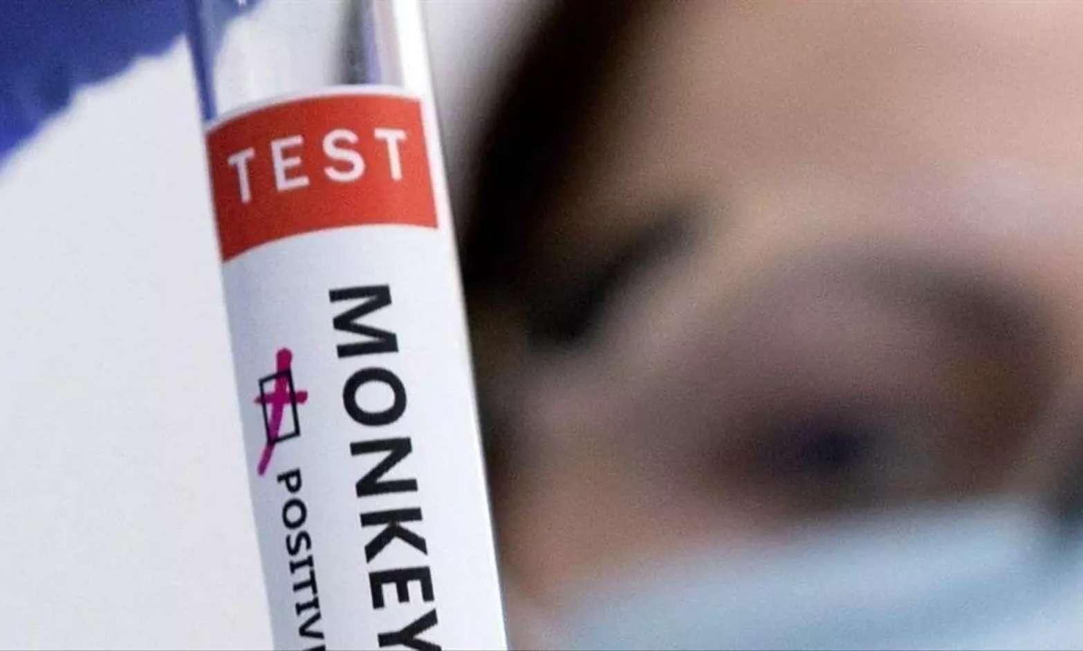 Reino Unido detecta nueva cepa de la viruela del mono en viajero procedente de Asia