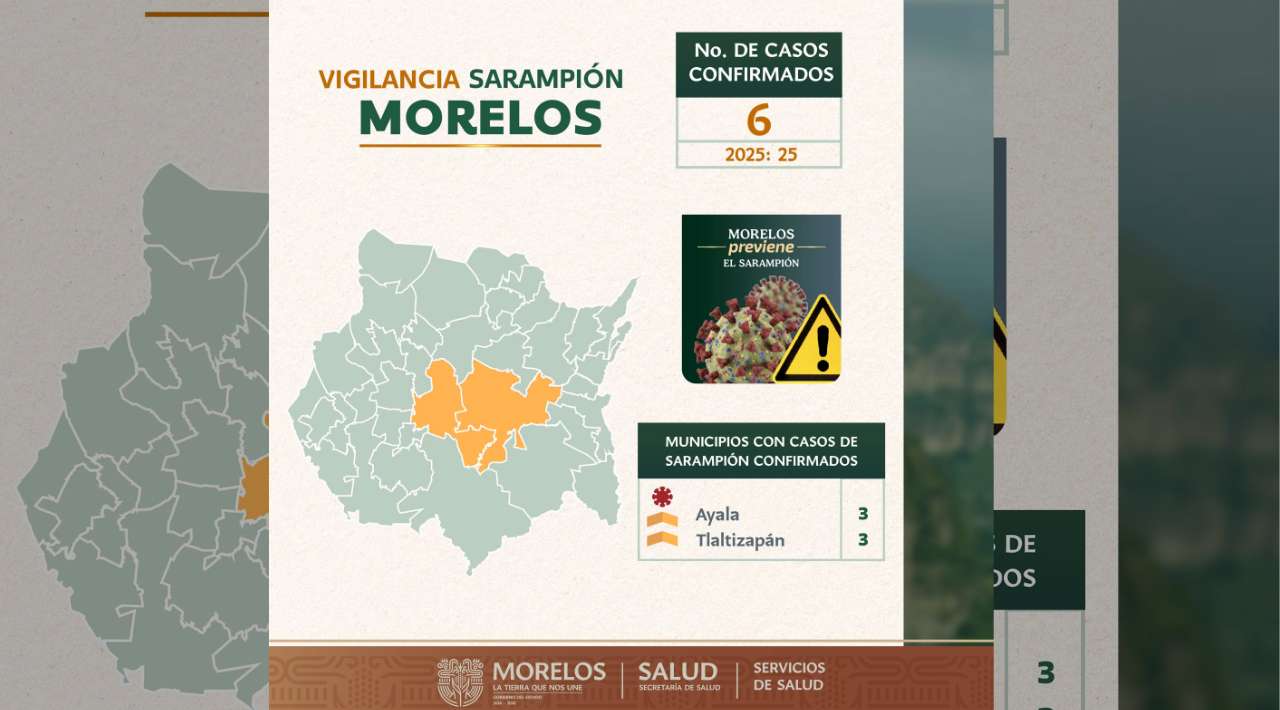 Confirman tres nuevos casos importados de sarampión en Tlaltizapán; suman seis en 2026
