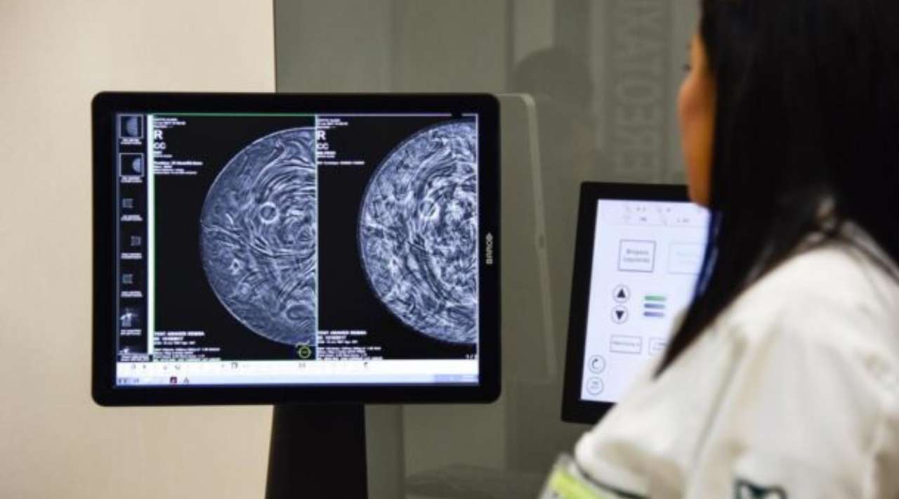 Más de 91 mil muertes por cáncer en un año en México reporta INEGI