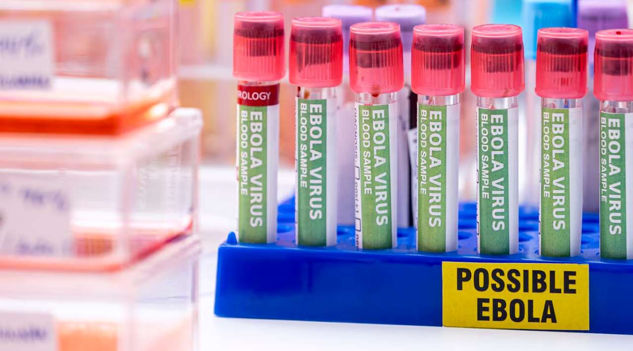 México emite aviso preventivo de viaje por brote de ébola en África