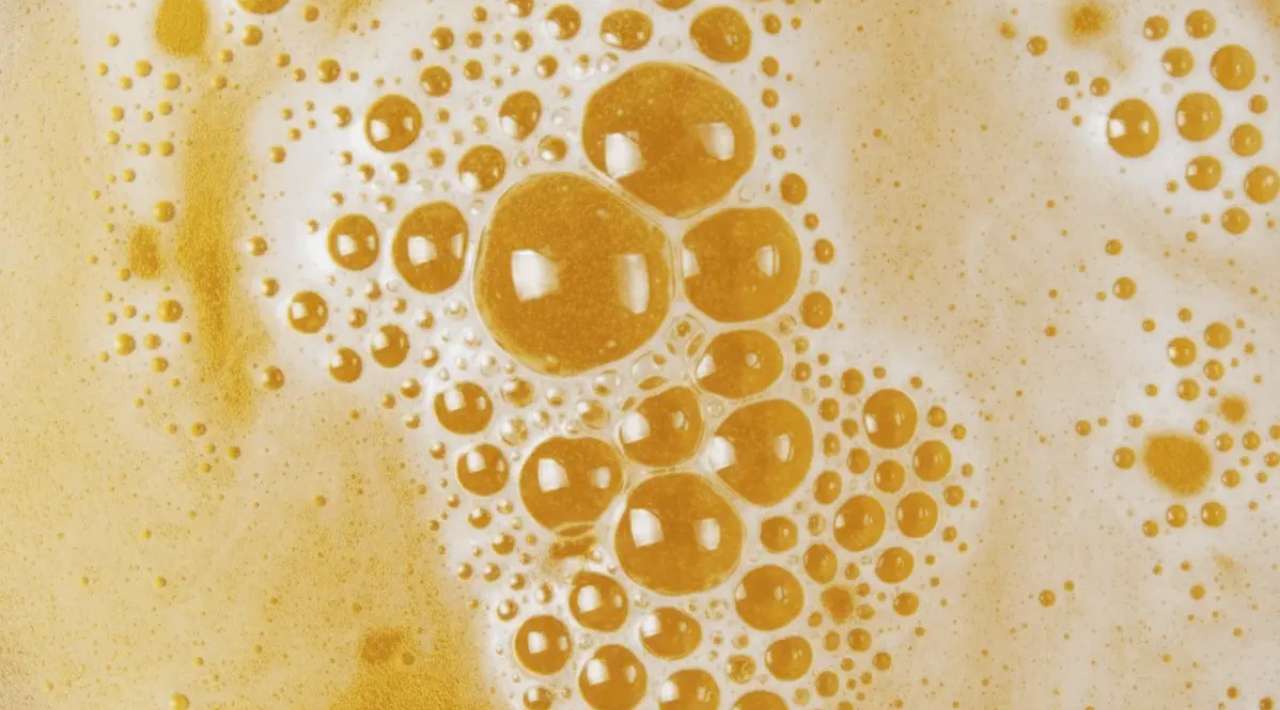 Orina con espuma o burbujas: cuándo es normal y cuándo puede ser una señal de alerta